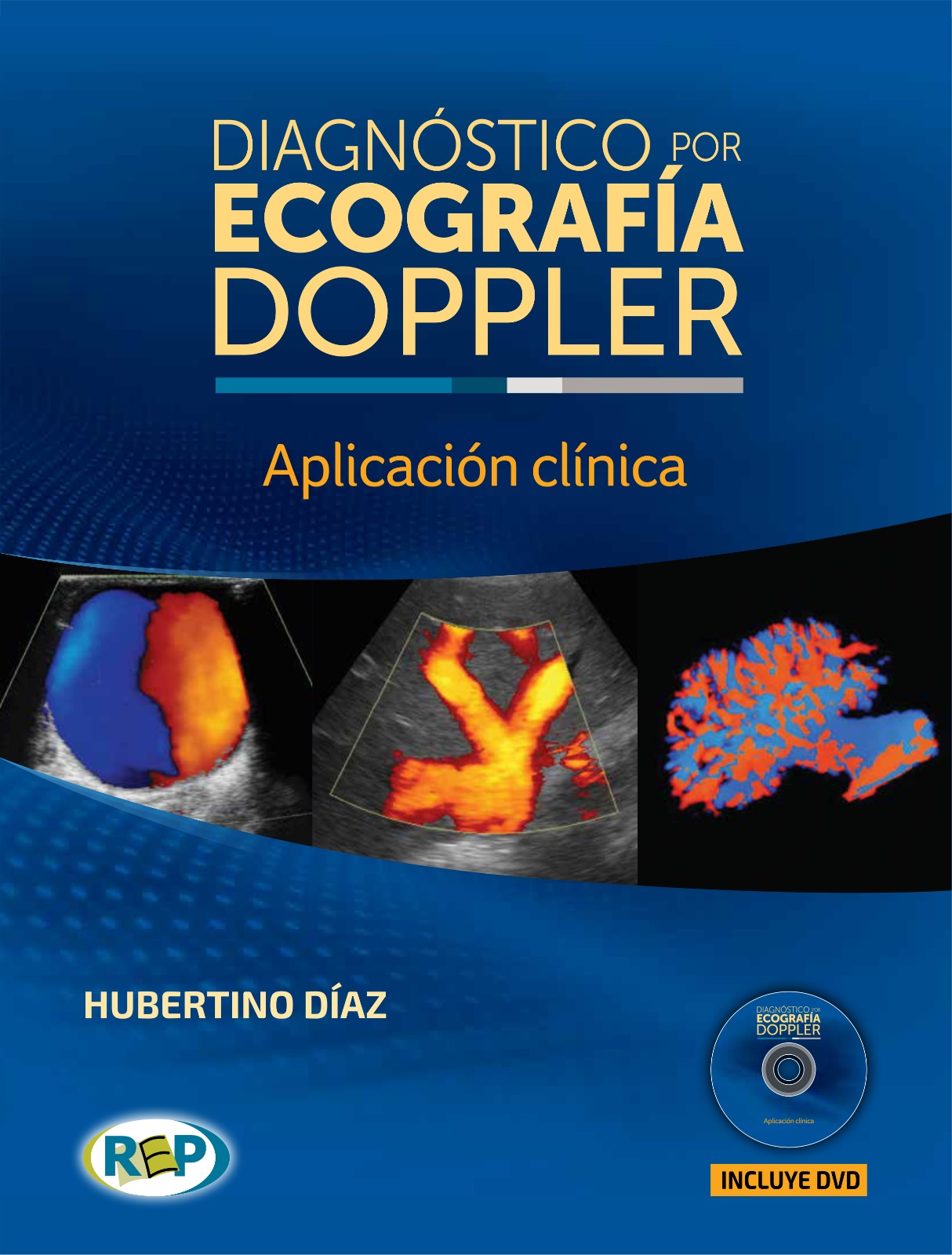 Portada Libro Diagnóstico por Ecografía Doppler - Dr. Hubertino Díaz